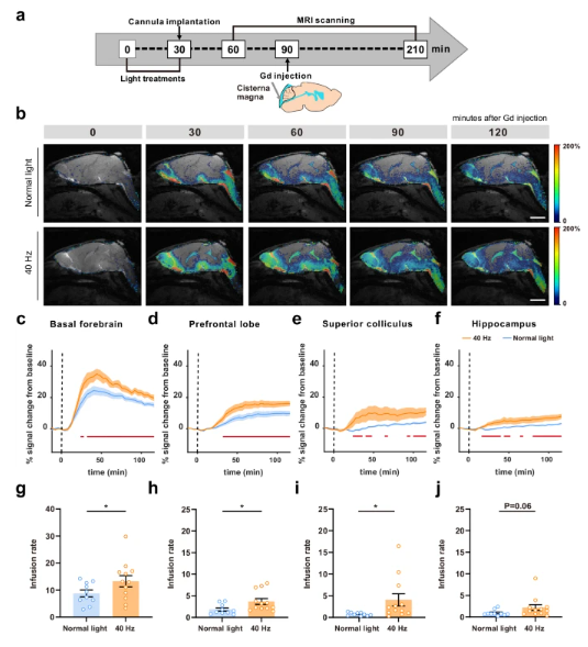 How Benadryl Affects the Aging Brain? How Benadryl Affects the Aging Brain?