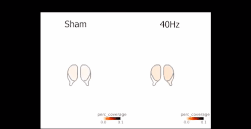 How Benadryl Affects the Aging Brain?