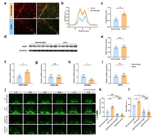 How Benadryl Affects the Aging Brain? How Benadryl Affects the Aging Brain?