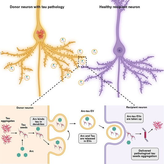 Scientists Have Finally Discovered How Alzheimer’s Disease Spreads in the Brain