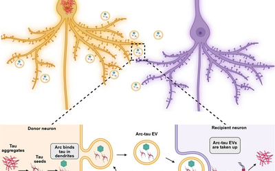 Scientists Have Finally Discovered How Alzheimer’s Disease Spreads in the Brain