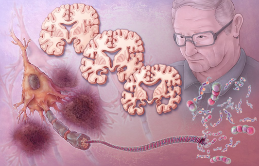 When Memory Fades Quietly – How to Detect Alzheimer's Disease Early