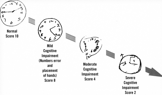 Can Drawing a Clock Really Detect Alzheimer's? — A Guide to Simple Screening Tools