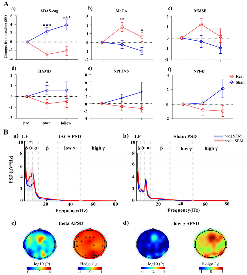 Effects of 40 Hz Transcranial Alternating Current Stimulation on Cognitive Changes and Neural Markers in Alzheimer's Disease: A Randomized, Double Blind, Sham Controlled Trial - ZenWave Precision 40Hz