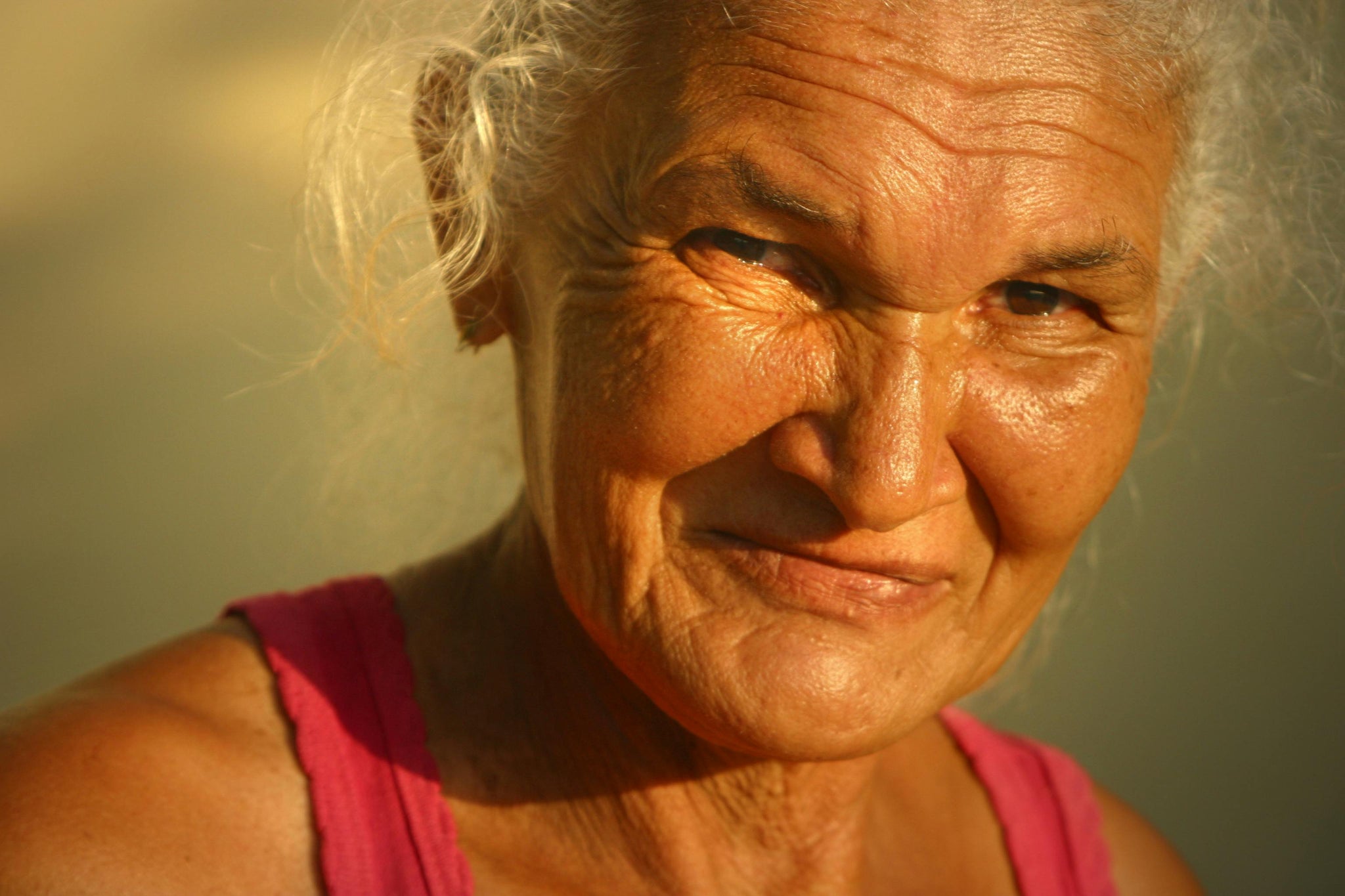 Frontotemporal Dementia: A Devastating Form of Dementia Often Misunderstood