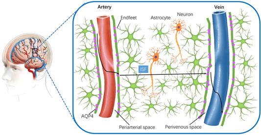 How Does 40 Hz Multisensory Stimulation "Wash" the Brain? A Novel Mechanism of Glymphatic Clearance of Amyloid Beta - ZenWave Precision 40Hz
