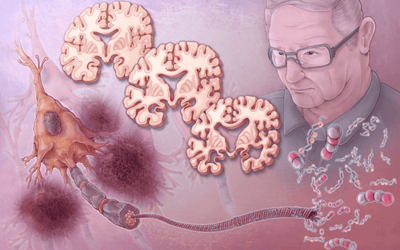 When Memory Fades Quietly – How to Detect Alzheimer's Disease Early