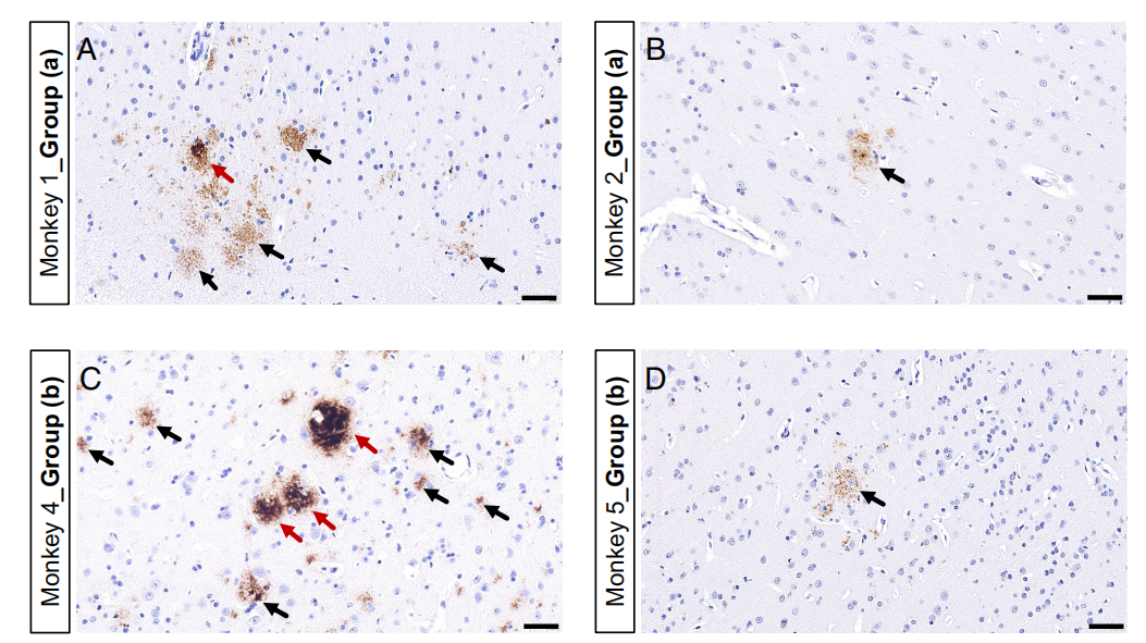 How Benadryl Affects the Aging Brain?